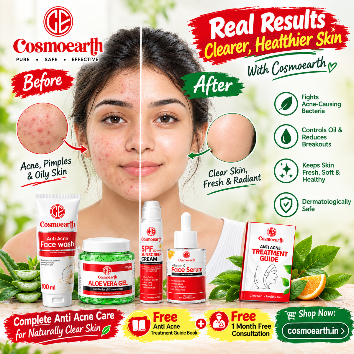Cosmoearth Anti Acne Skincare Box for Acne Prone Skin, 4 Piece Set