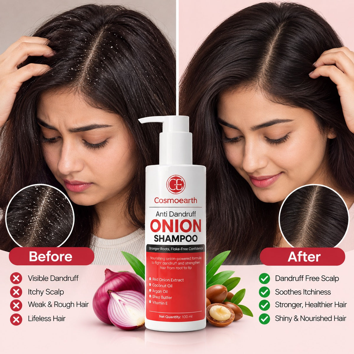 Cosmoearth Anti Dandruff Onion Shampoo – Red Onion Extract – 100 ml